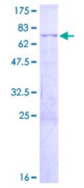 SDS-PAGE (CEBPB-1101H).jpg